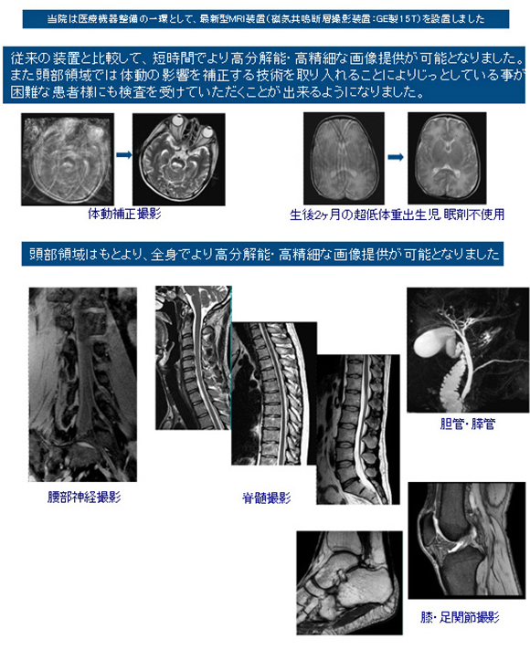 当院のMRIのお知らせ